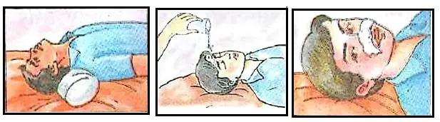 First-Aid-Class-5-EVS-Chapter-Notes-Bleeding-Nose