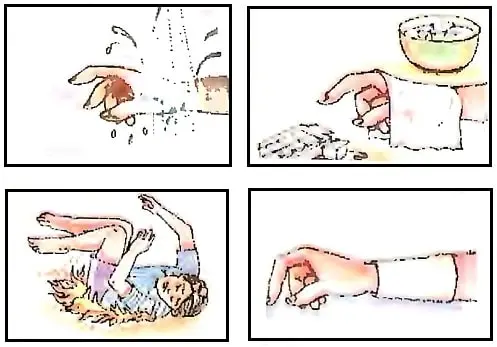 First-Aid-Class-5-EVS-Chapter-Notes-Burns