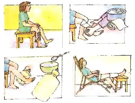  First-Aid-Class-5-EVS-Chapter-Notes-Sprain